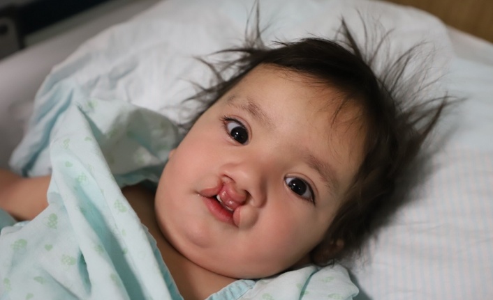 Doğuştan Dudak-Damak Yarığı Olan 9 Aylık Bebek, KSÜ Tıp’ta Sağlığına Kavuştu